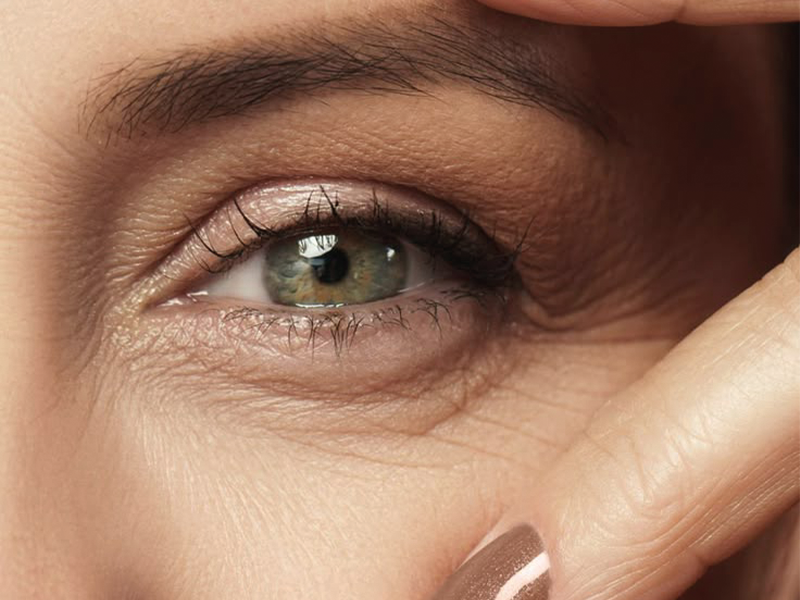 Cirurgia de pálpebras, entenda tudo sobre a blefaroplastia