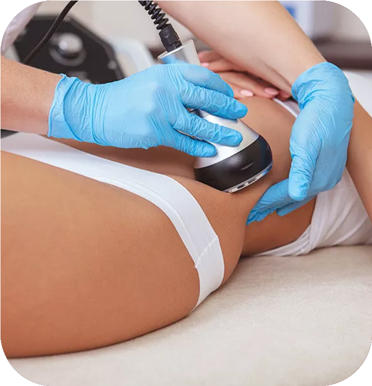Lipo Lipocavitação Focalizada