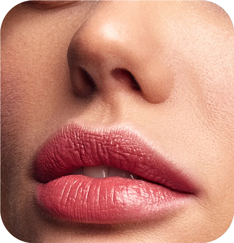 Lip Lift em Uberlândia – MG