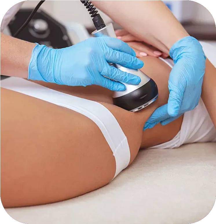 Lipocavitação Focalizada em Uberlândia – MG